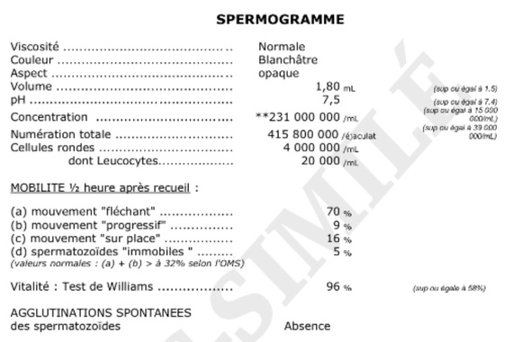 spermogramme résultat spermogramme résultat